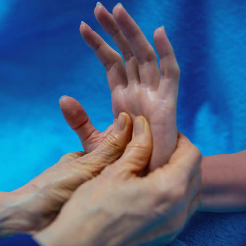 Bilder der Behandlung einer Hand